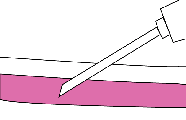 Graphic showing needle entering blood vein